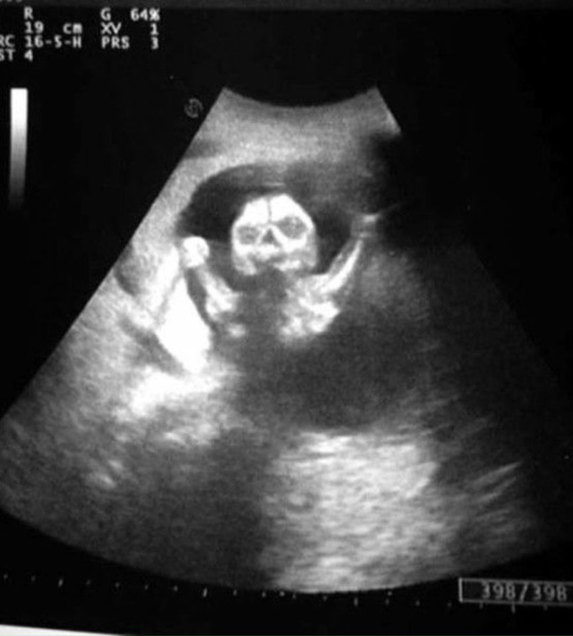 9 лет работаю узисткой в больнице. И иногда даже мне стр...