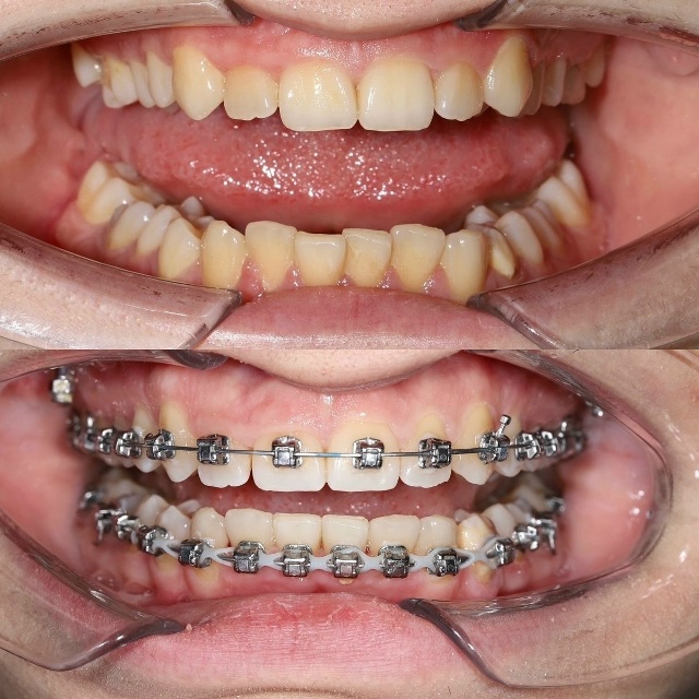 СТОМАТОЛОГИЯ Эмидент 📲 8-800-555-73-67 • nfk.emident.ru
🏠 Нефтека...