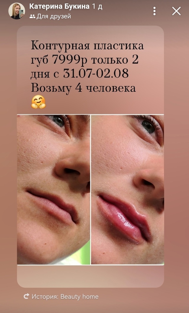 Девочки и мальчики!
Небольшие акции для Вас 🫶
📌Биоре?...