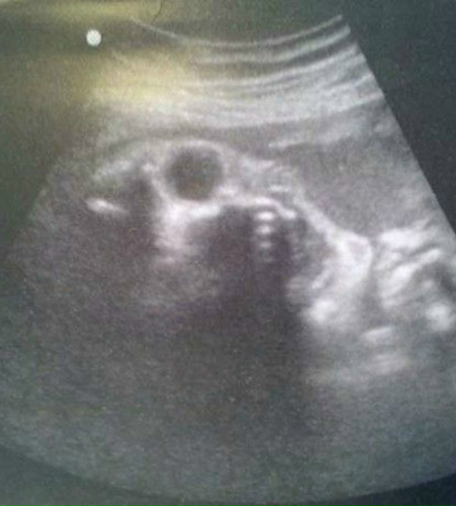 9 лет работаю узисткой в детской больнице. И иногда даж?...