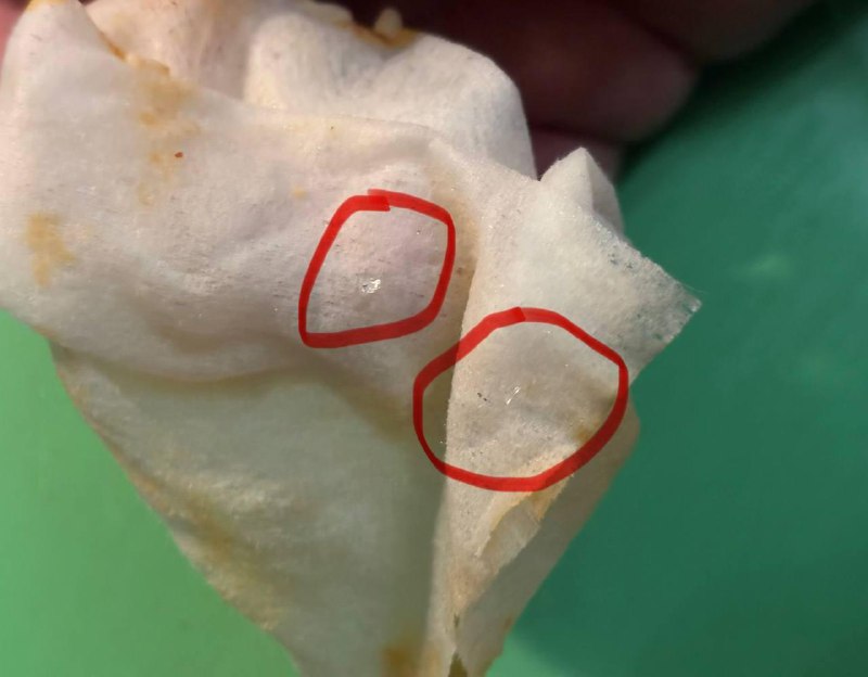 Битое стекло вместо начинки обнаружила москвичка в пельменях из доставки.
Девушка заказала пачку г