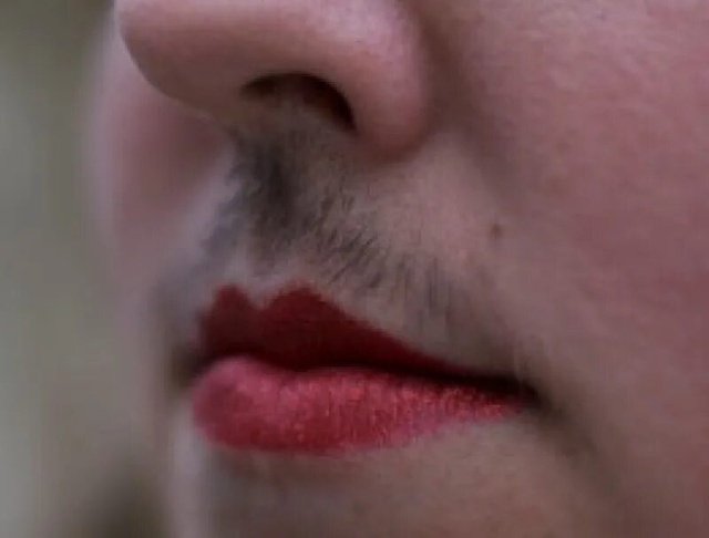 Усы начали маcсово вырастать у девочек-подростков по вc...