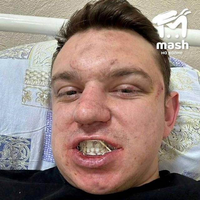 В Симферополе праздничный банкет закончился реанимацией для официанта. Его били целый час, потому чт