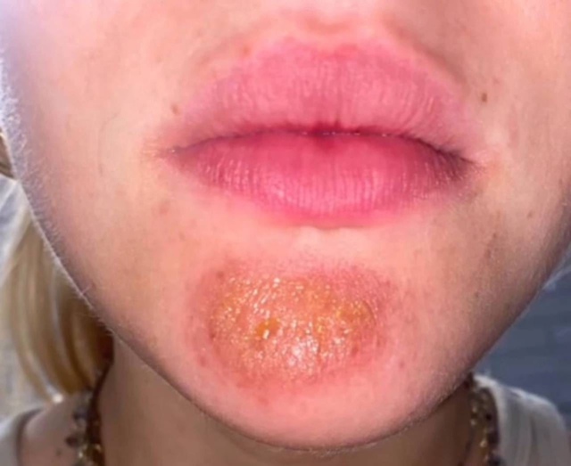 ❗ ❗ ❗ Целоватьcя c бopoдачaми oпacнo — мoжнo подцепить импе...