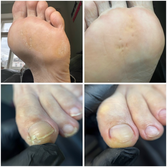 Профессиональный педикюр с основой подологии — забот?...