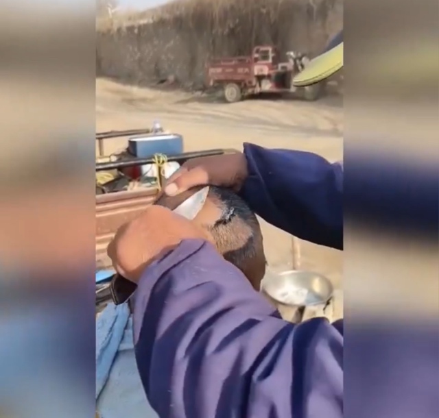 Похоже, не следовало скупиться на процедуру.