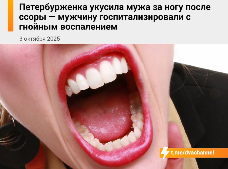 Петербуржец попал в больницу после укуса… жены
В Питере семейная ссора закончилась для мужчины боль