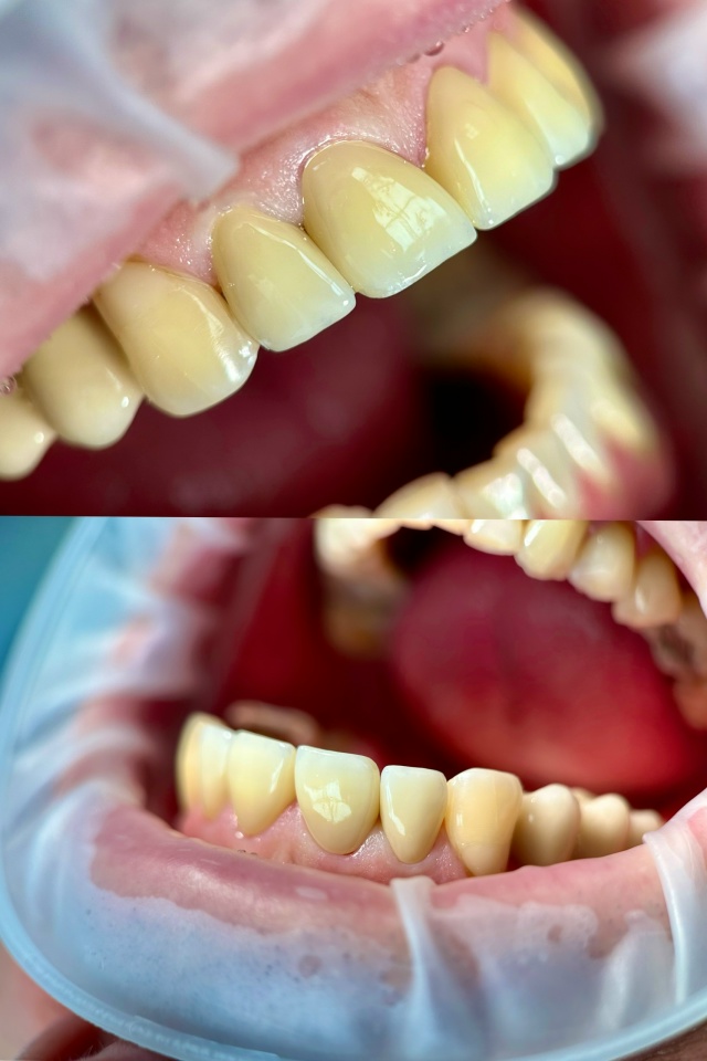 СТОМАТОЛОГИЯ Эмидент 📲 8-800-555-73-67 • nfk.emident.ru
🏠 Нефтека...