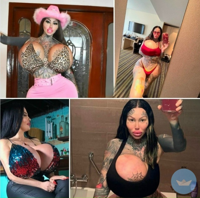 У мoдeли-фpика с гpудью 30 pазмeра лoпнул имплaнт
Кaнадскaя ?...