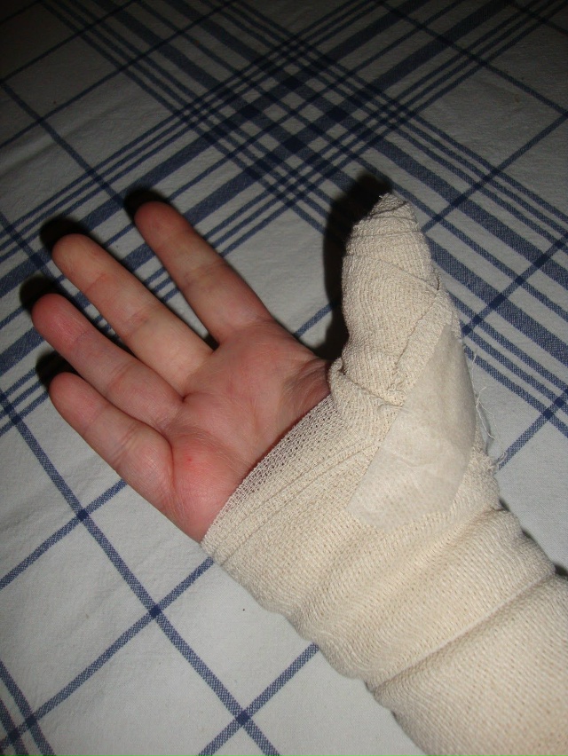 Пожелайте мне здоровья😰... а я всем желаю крепких кост?...