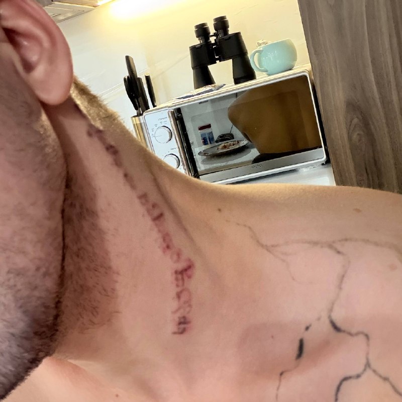 Откатываемся к заводским настройкам 😅
Удаление тату - тот ещё «спа-процедурный» опыт 😰