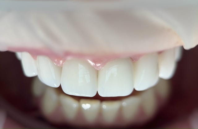 СТОМАТОЛОГИЯ Медента 📲 8-800-555-73-67
🏠 Бирск Октябрьская ...