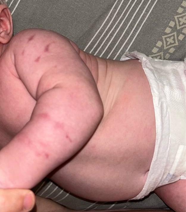 В детской поликлинике работают живодеры! Малышу 2х мес?...