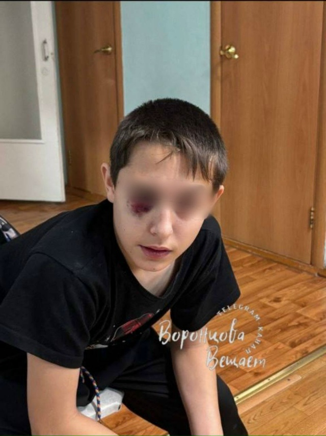 😱 «Споткнулся о тумбочку»: мать из Кинеля обвиняет са?...