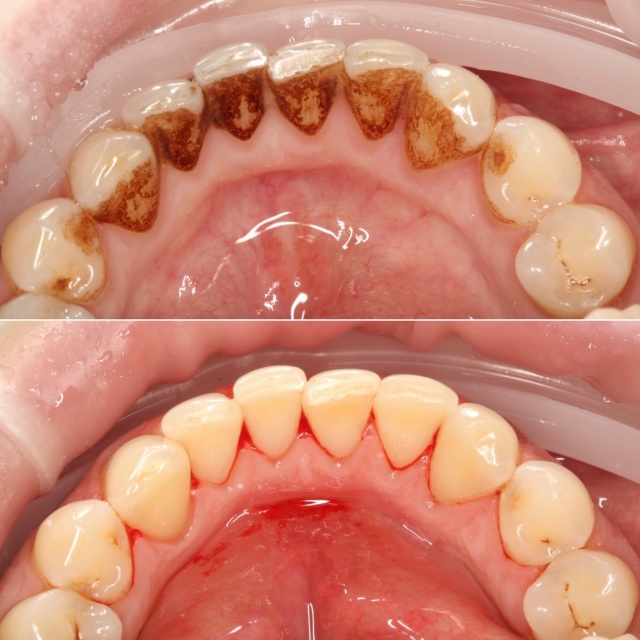 СТОМАТОЛОГИЯ Эмидент 📲 8-800-555-73-67 • stm.emident.ru
🏠 Стерлит...