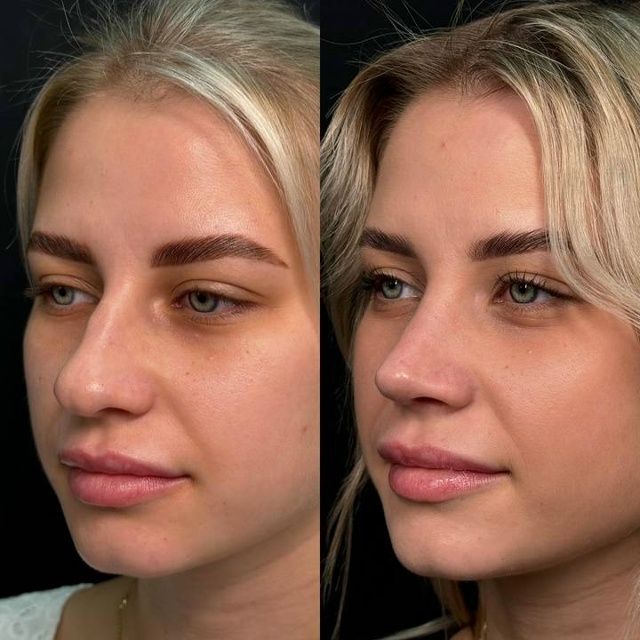 Дарья Поцелуева перешла от рекламы девушки списываеще...