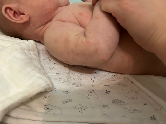 SOS‼️помогите, пожалуйста, вpачи не могут сказать что э?...