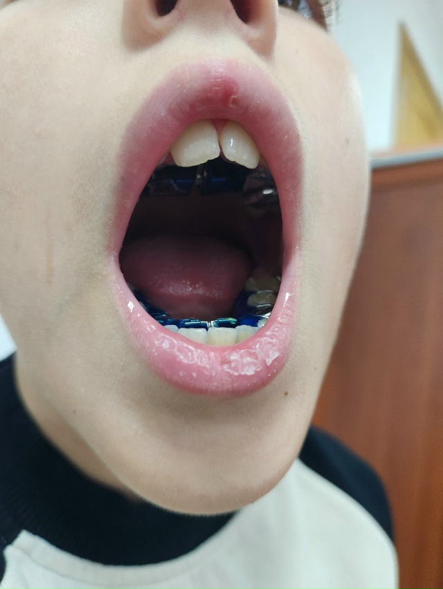 Анонимно пожалуйста. Здравствуйте,уважаемые коллеги! ...