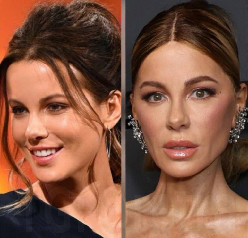 Кейт Бекинсейл шокировала зрителей на шоу Джимми Киммела.
56-летняя звезда «Другого мира» и «Ван Хе