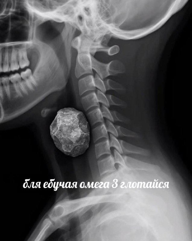 Я каждое утро