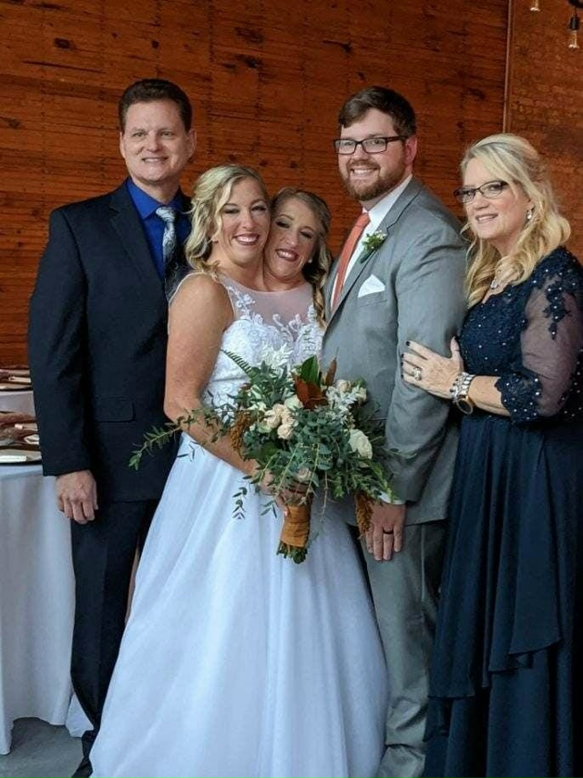 Сиамские близнецы вышли замуж. Точнее, одна из них😅
В ...