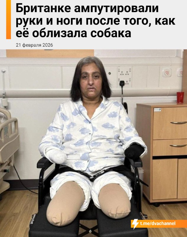 Британке ампутировали руки и ноги после того, как её облизала собака
В июле 52-летняя Манджит Сангх