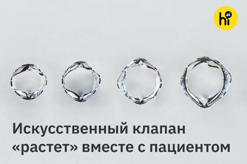 ❤️ Ребенку установили сердечный клапан, который сможет «расти» вместе с ним
В детской больнице при