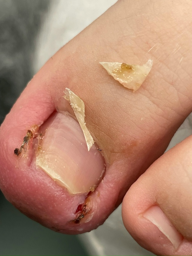 Добрый день!
С 14.11-16.11 ведет прием Нижегородский подоло?...