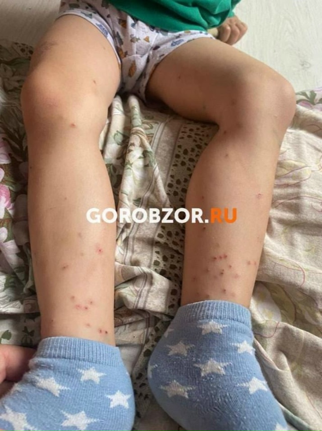 😡 «Детей кусают блохи»: родители требуют проверки уфи...