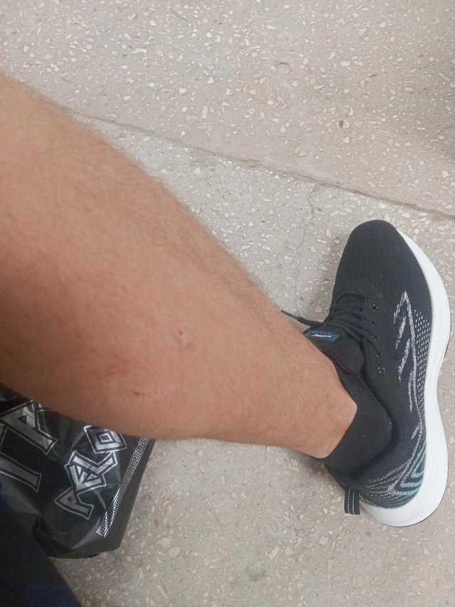 В Шанхае видимо беспризорная собака бегает. Сегодня вц...