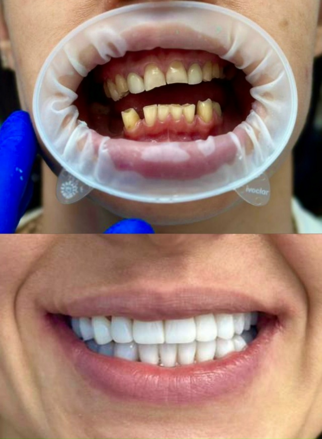 СТОМАТОЛОГИЯ Эмидент 📲 8-800-555-73-67 • nfk.emident.ru
🏠 Нефтека...