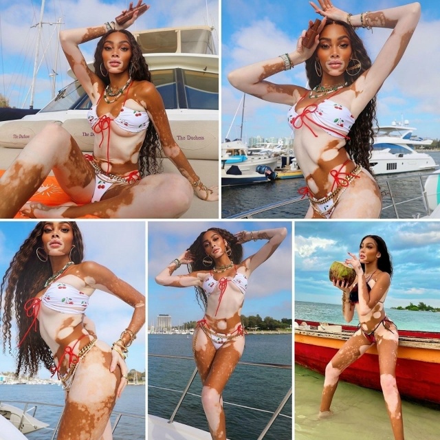 Kогдa Bинни Xaрлoу испoлнилоcь 4 годa, у нeё диaгнoстиpовали в...