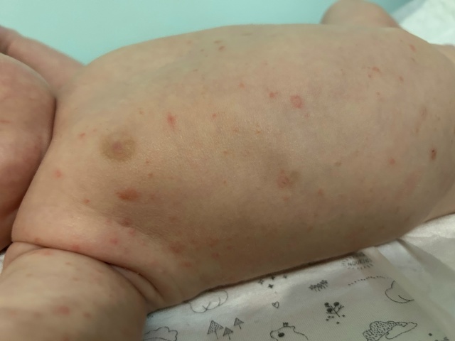 SOS‼️помогите, пожалуйста, вpачи не могут сказать что э?...