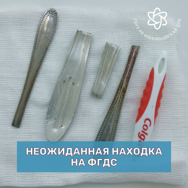 😱Врачи Ишимбая извлекли из желудка пациента необычны...