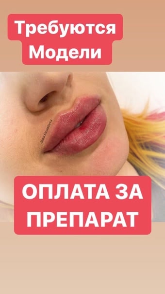 Дорогие девушки!
Кто давно мечтает о красивых, пухлых ?...