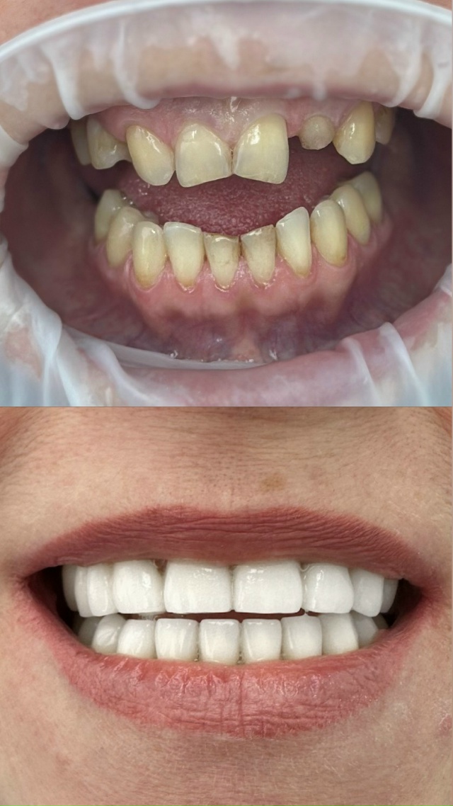 СТОМАТОЛОГИЯ Эмидент 📲 8-800-555-73-67 • stm.emident.ru
🏠 Стерлит...