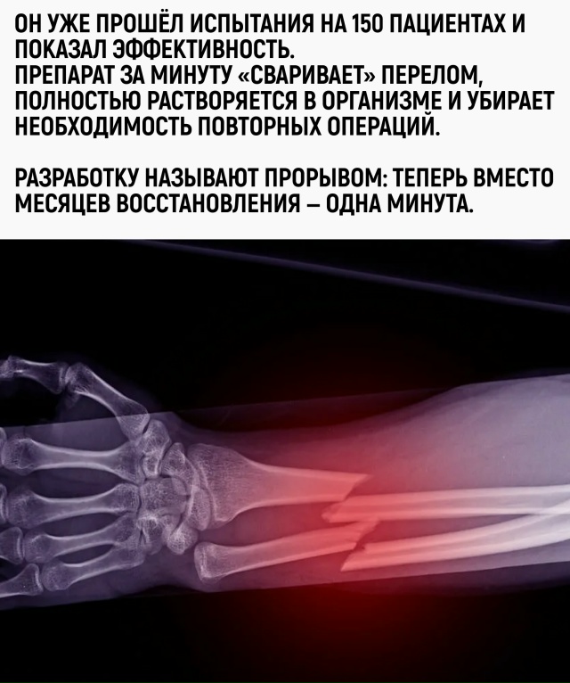 Китайцы сделали клей для костей. Похоже, ПВА и «Момент»...