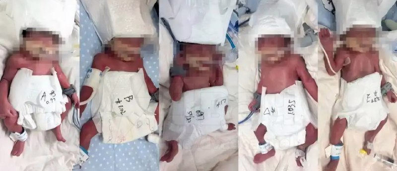 В Китае 24-летняя тян родила сразу пятерняшек: шанс такого комбо при естественном зачатии — один на