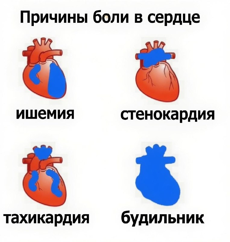 Резкий подъём по будильнику может закончиться смертью.
Учёные предупреждают, что внезапное пробужде