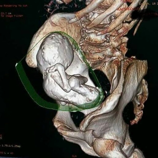 😱Когда 73-летняя женщина обратилась к врачам с жалобам...