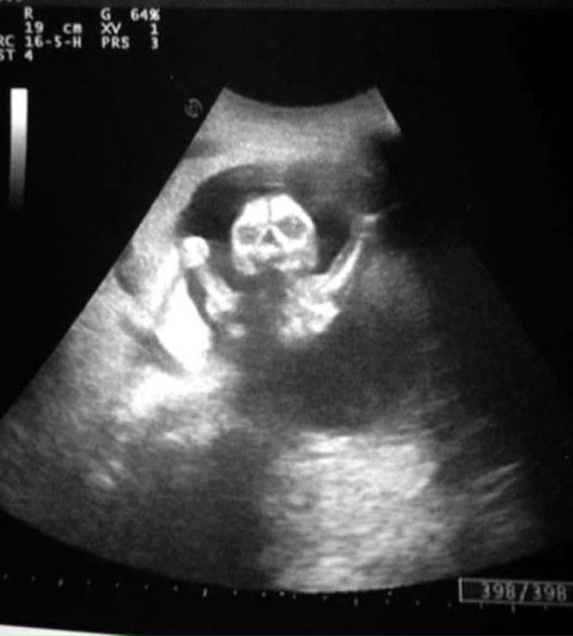 9 лет работаю узисткой в детской больнице. И иногда даж?...