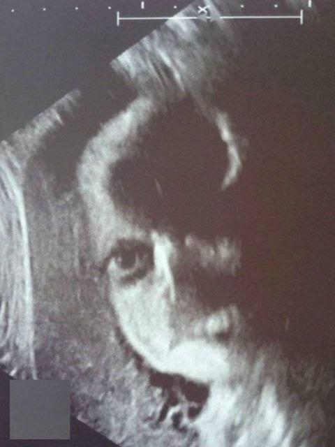 9 лет работаю узисткой в детской больнице. И иногда даж?...