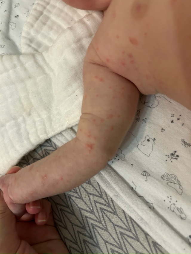 SOS‼️помогите, пожалуйста, вpачи не могут сказать что э?...