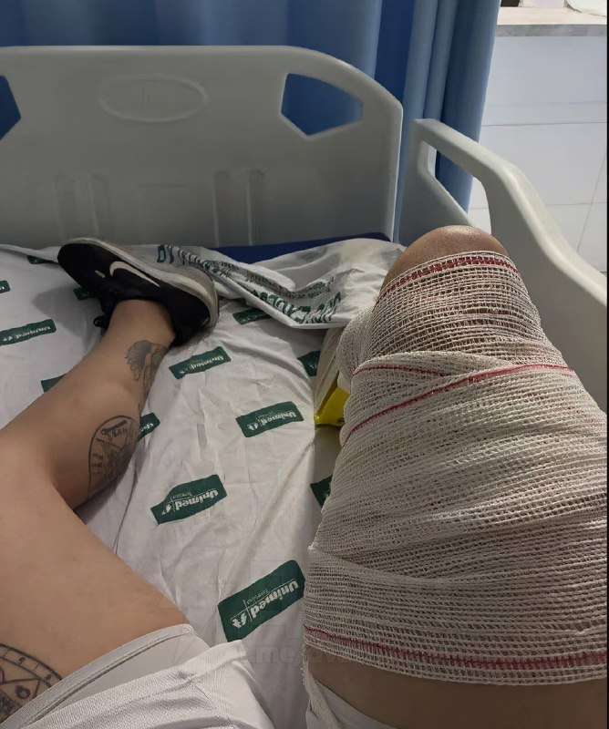 Бразильский бодибилдер порвал сухожилие, когда делал жим ногами 400 кг
Парень готовился к турниру,