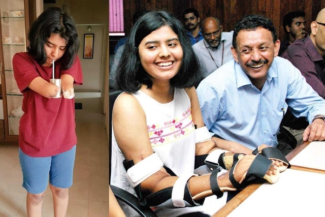 Новые руки Шрейи Сидданагоудер, пересаженные от донор?...