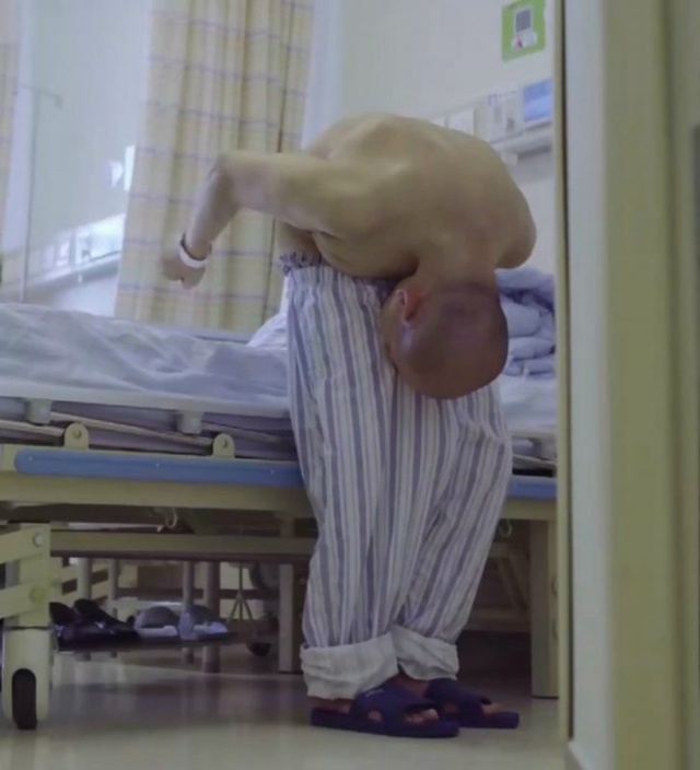 46-летний Ли Хуа в таком согнутом состоянии прожил окол?...