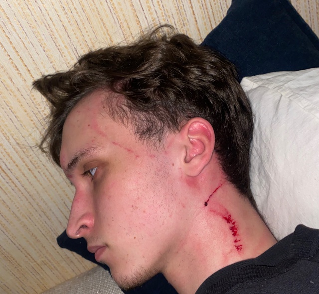 Доброго времени суток, прошу всех кто в 0:04 - 0:15, был на с?...