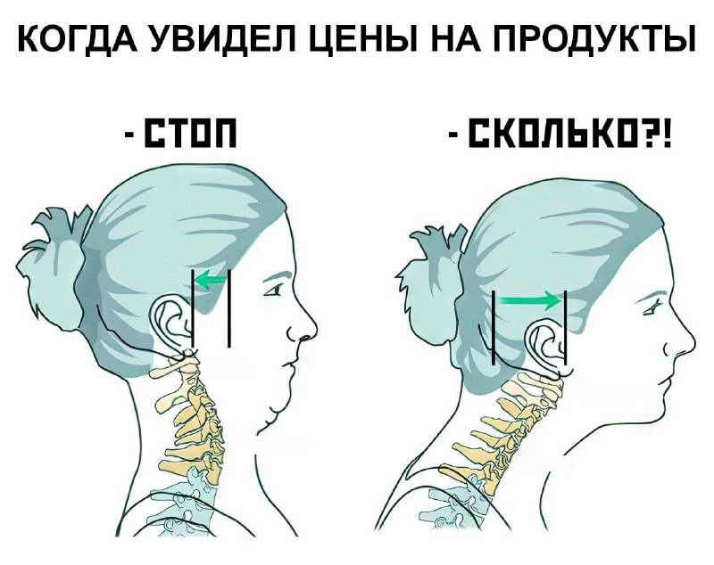 Традиционный борщевой набор (картошка, лук и капуста) подорожал более чем на 50% за год.