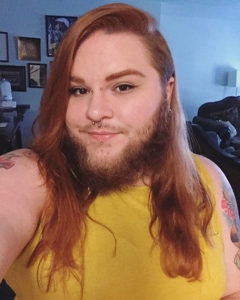 26-летняя Нова Галаксия страдает от поликистозного син?...