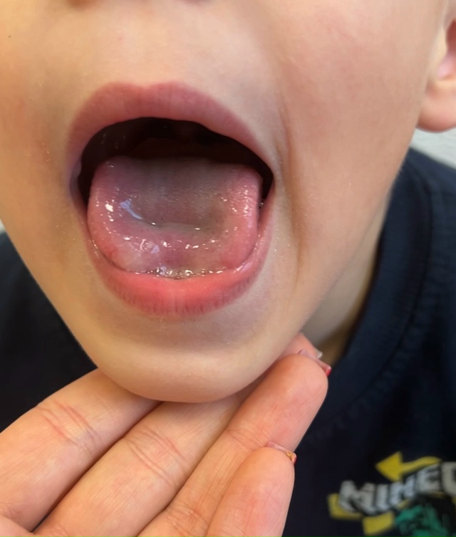 Здравствуйте, коллеги? Пришел мальчик, почти 6 лет. Нару...